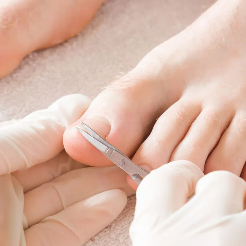 Pedicure